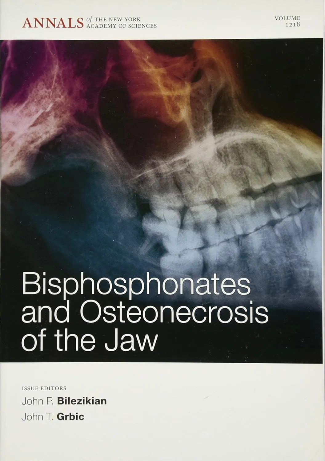 Bisphosphonates and Osteonecrosis of the Jaw