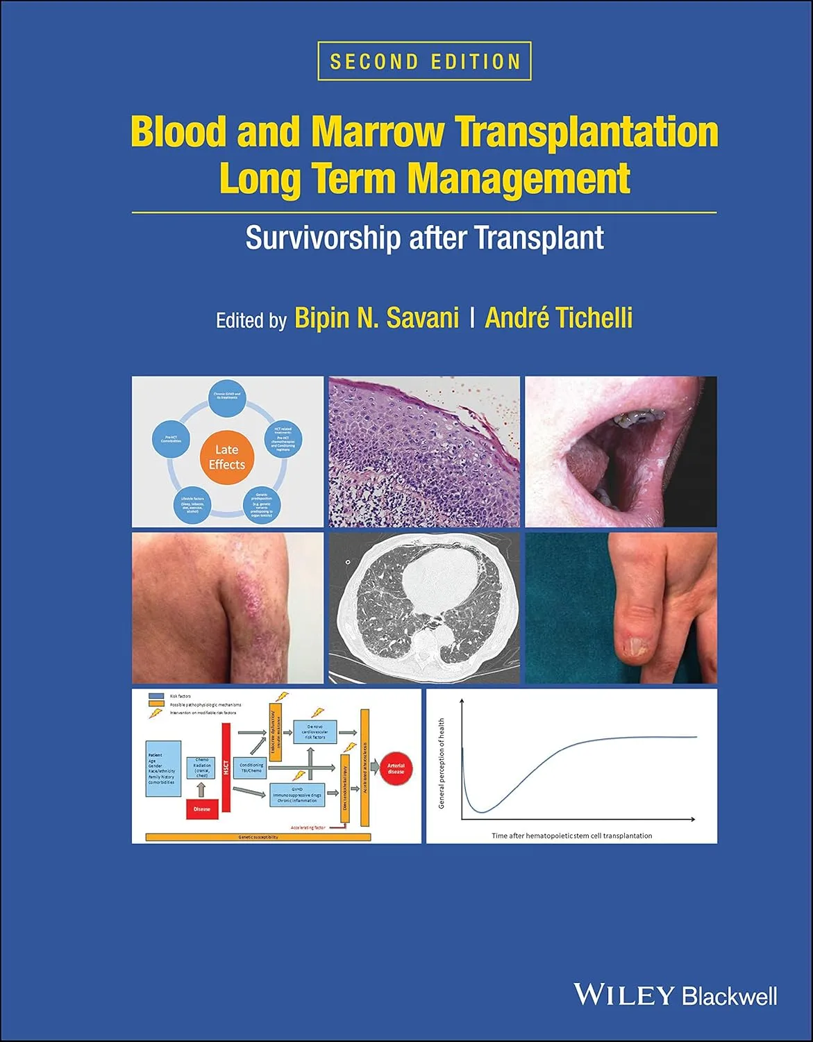 Blood And Marrow Transplantation Long Term Management Survivorship After Transplant 2nd Edition | Hardcover
