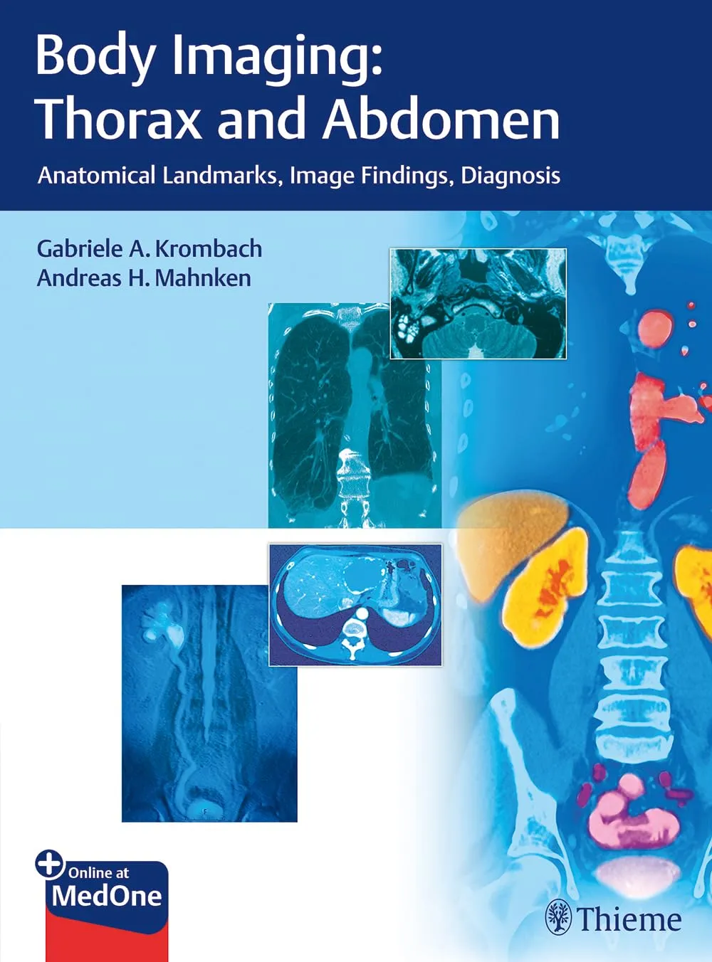 Body Imaging Thorax and Abdomen | Hardcover