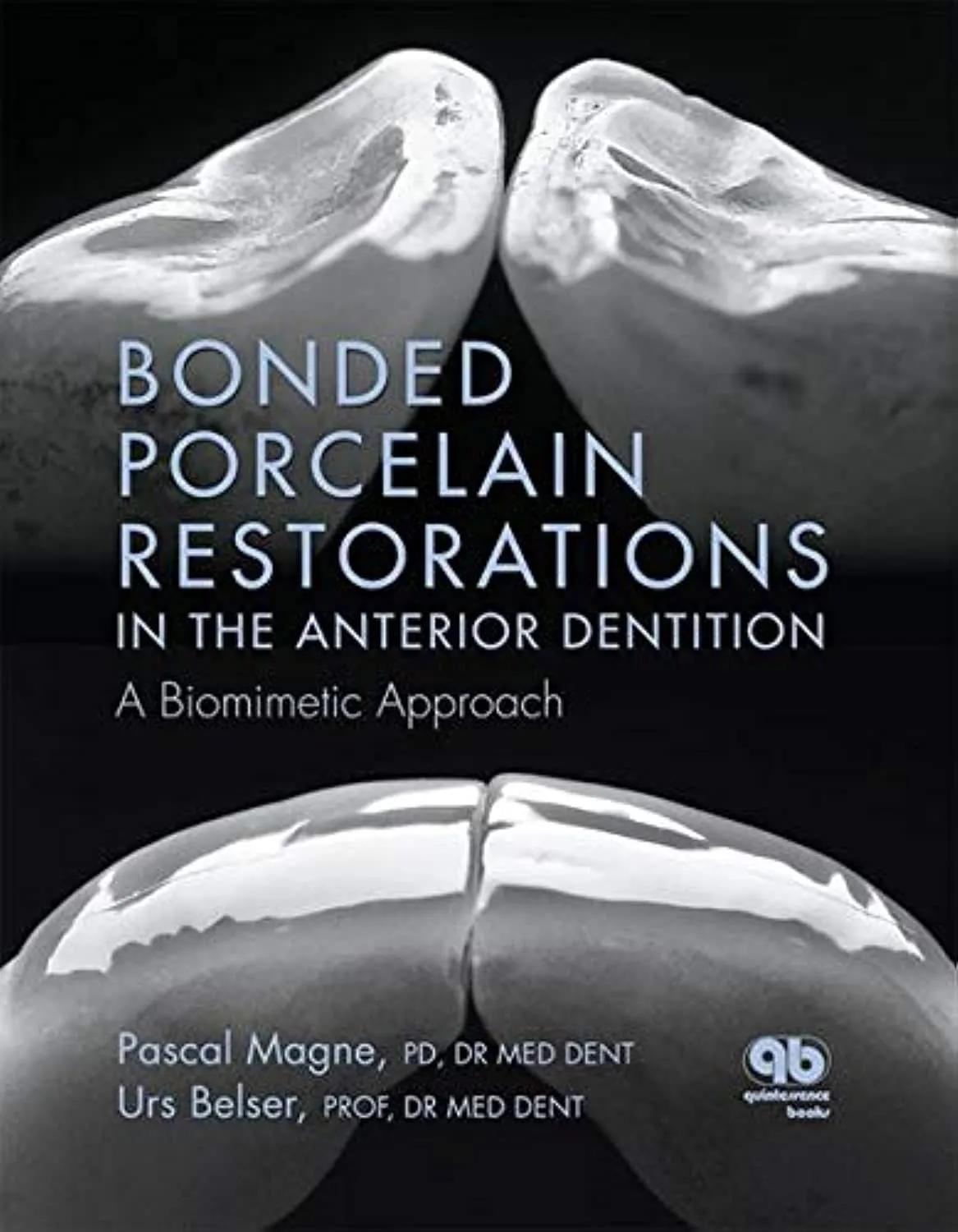Bonded Porcelain Restorations in the Anterior Dentition | Hardcover