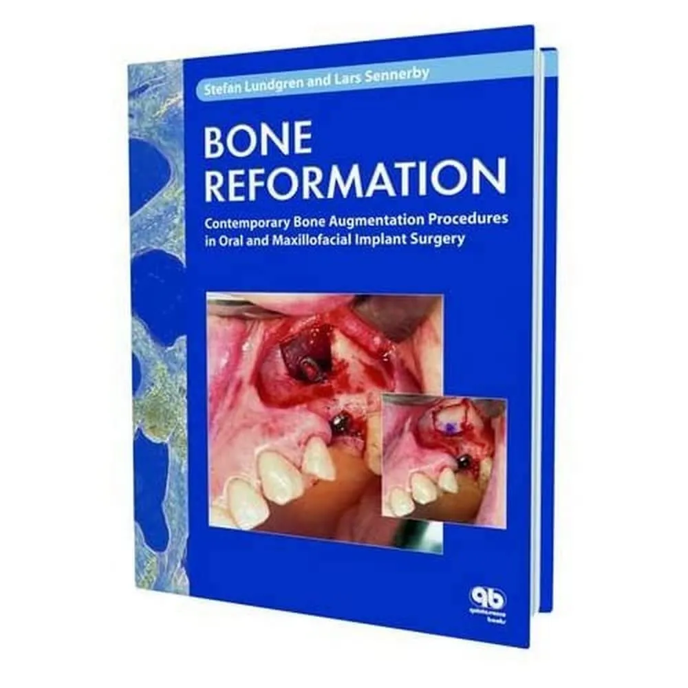 Bone Reformation Contemporary Bone Augmentation Procedures in Oral and Maxillofacial Implant Surgery | Hardcover