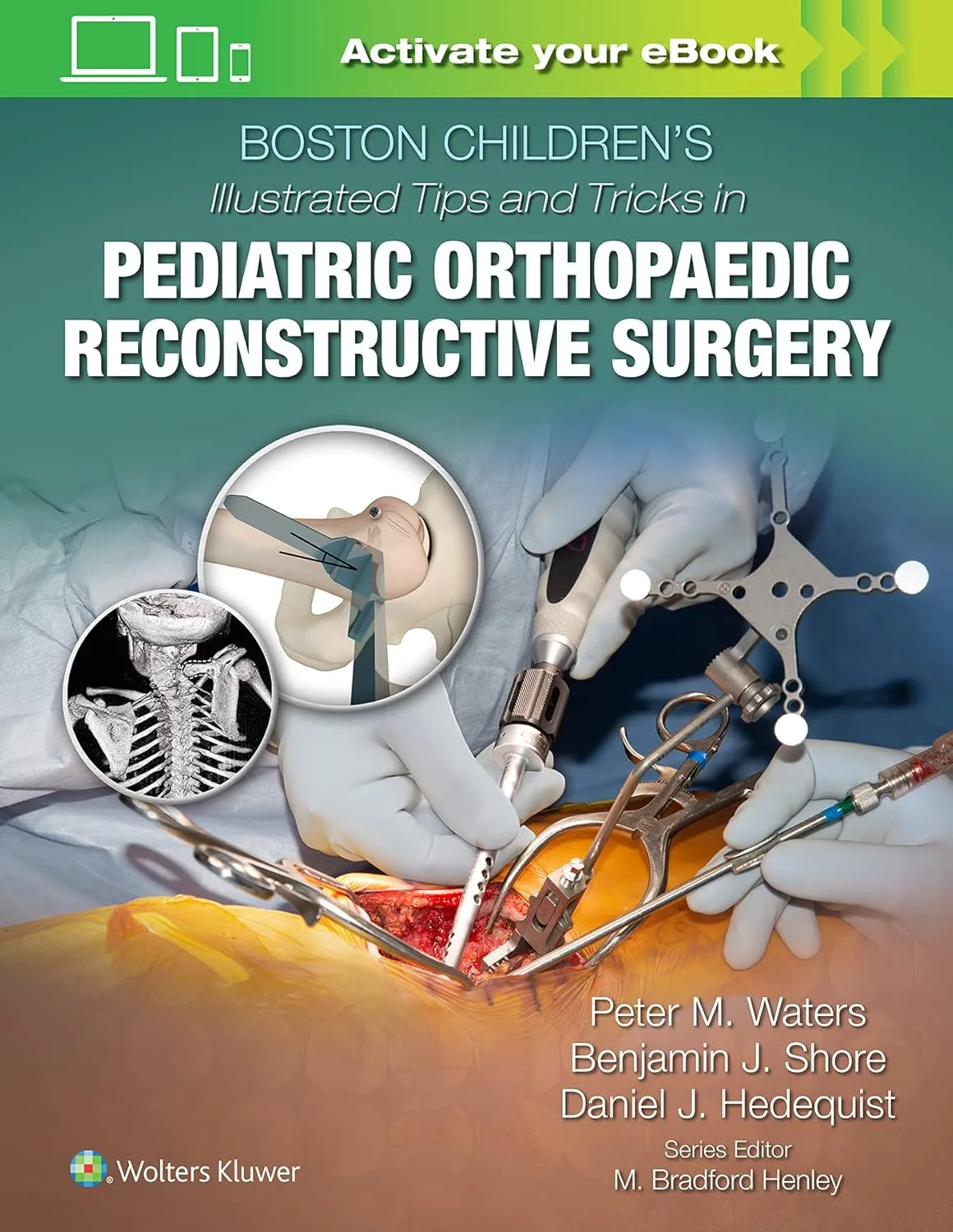 Boston Childrens Illustrated Tips And Tricks In Pediatric Orthopaedic Reconstructive Surgery | Hardcover