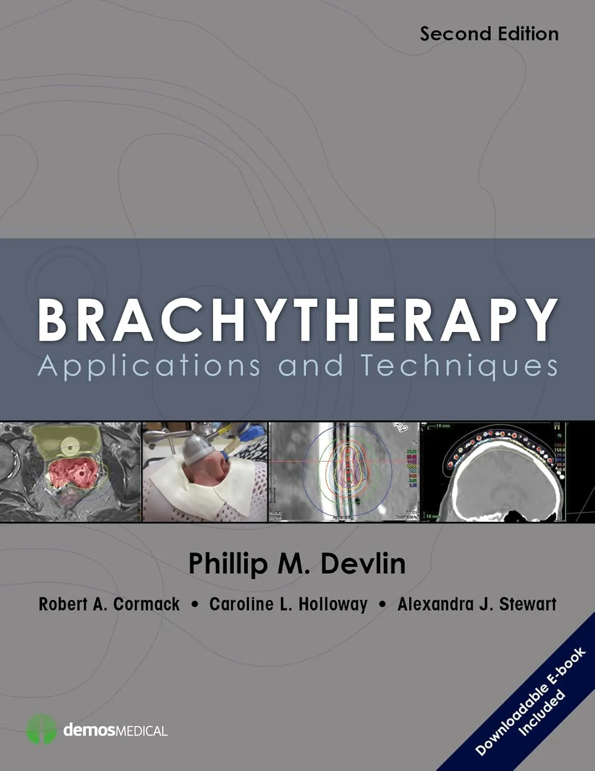Brachytherapy Applications and Techniques | 2nd Edition | Hardcover