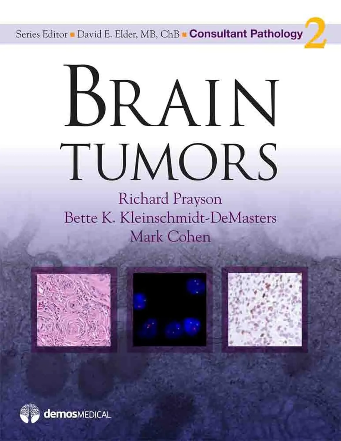 Brain Tumors Consultant Pathology | Hardcover