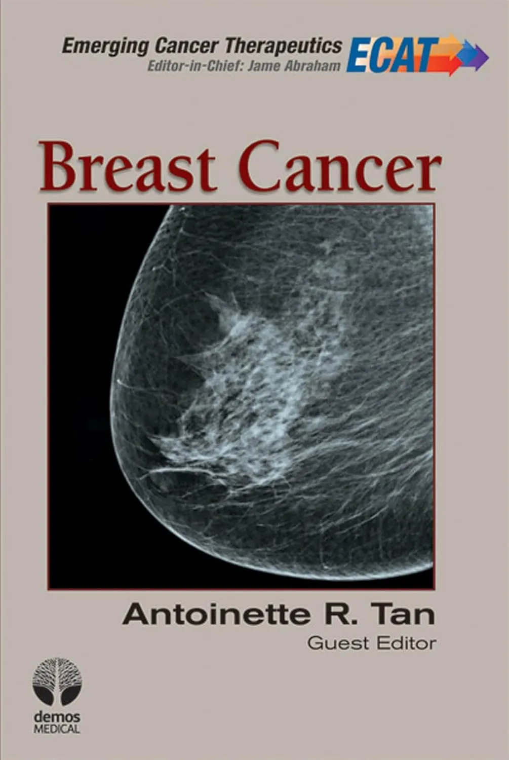 Breast Cancer | Hardcover