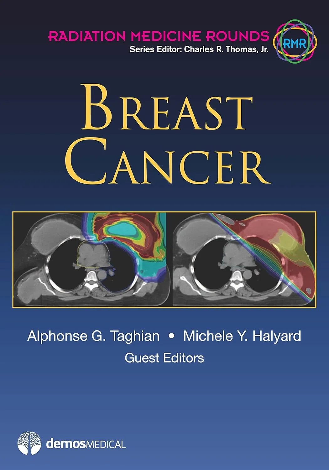 Breast Cancer | Hardcover