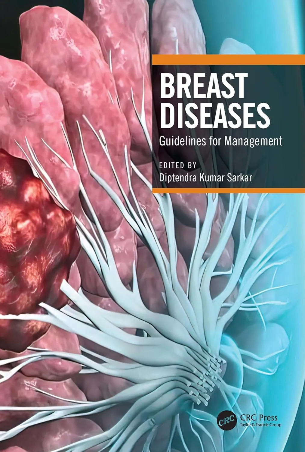 Breast Diseases Guidelines For Management | Paperback