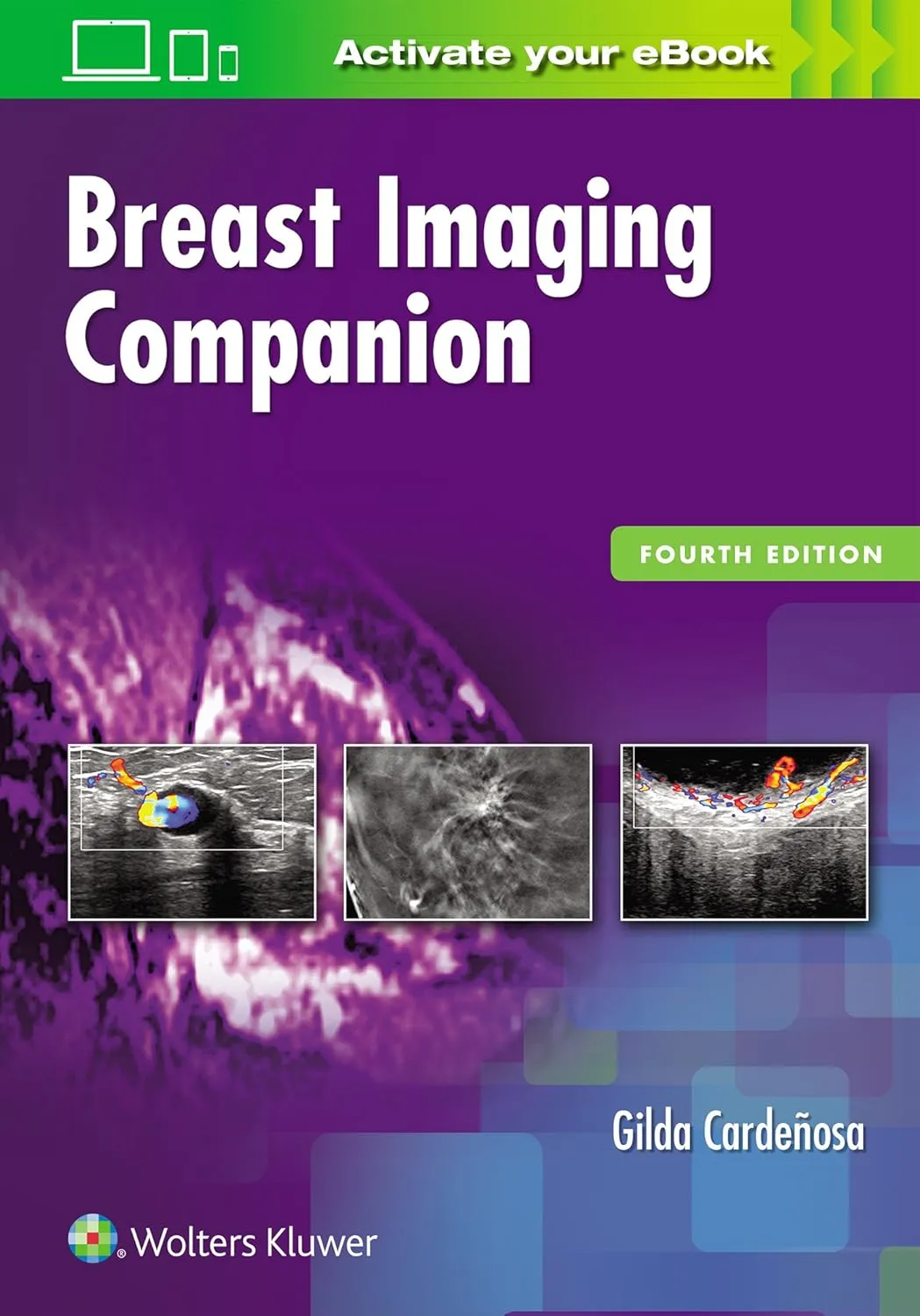 Breast Imaging Companion | 4th Edition | Paperback