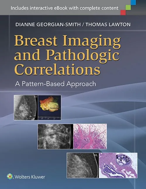 Breast Imaging and Pathologic Correlations A Pattern-Based Approach | Hardcover