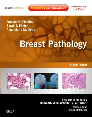 Breast Pathology | 2nd Edition | Hardcover