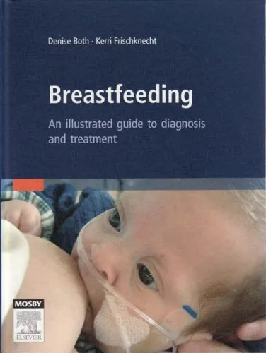 Breastfeeding An Illustrated Guide to Diagnosis and Treatment | Hardcover