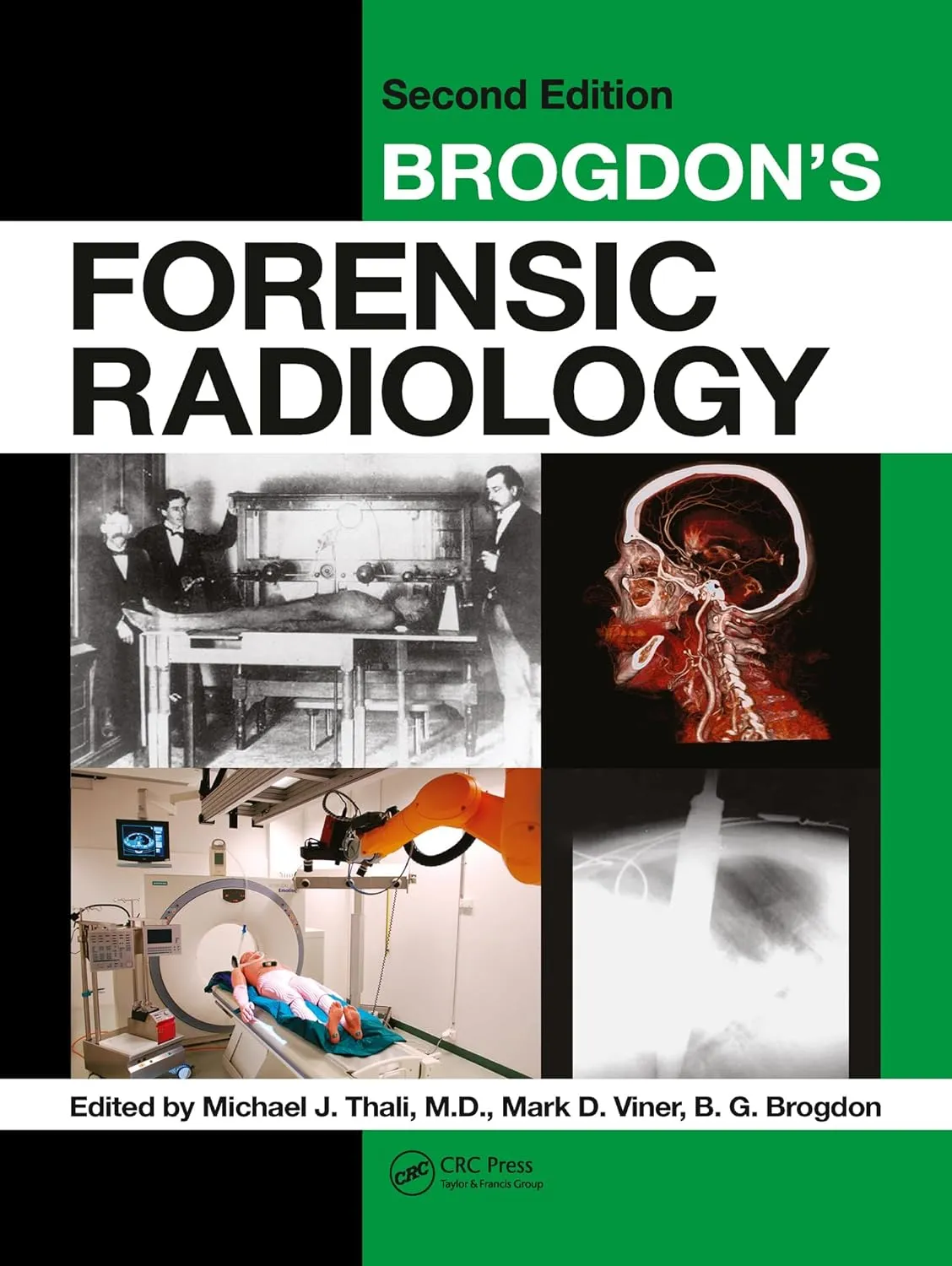 Brogdon's Forensic Radiology | 2nd Edition | Hardcover