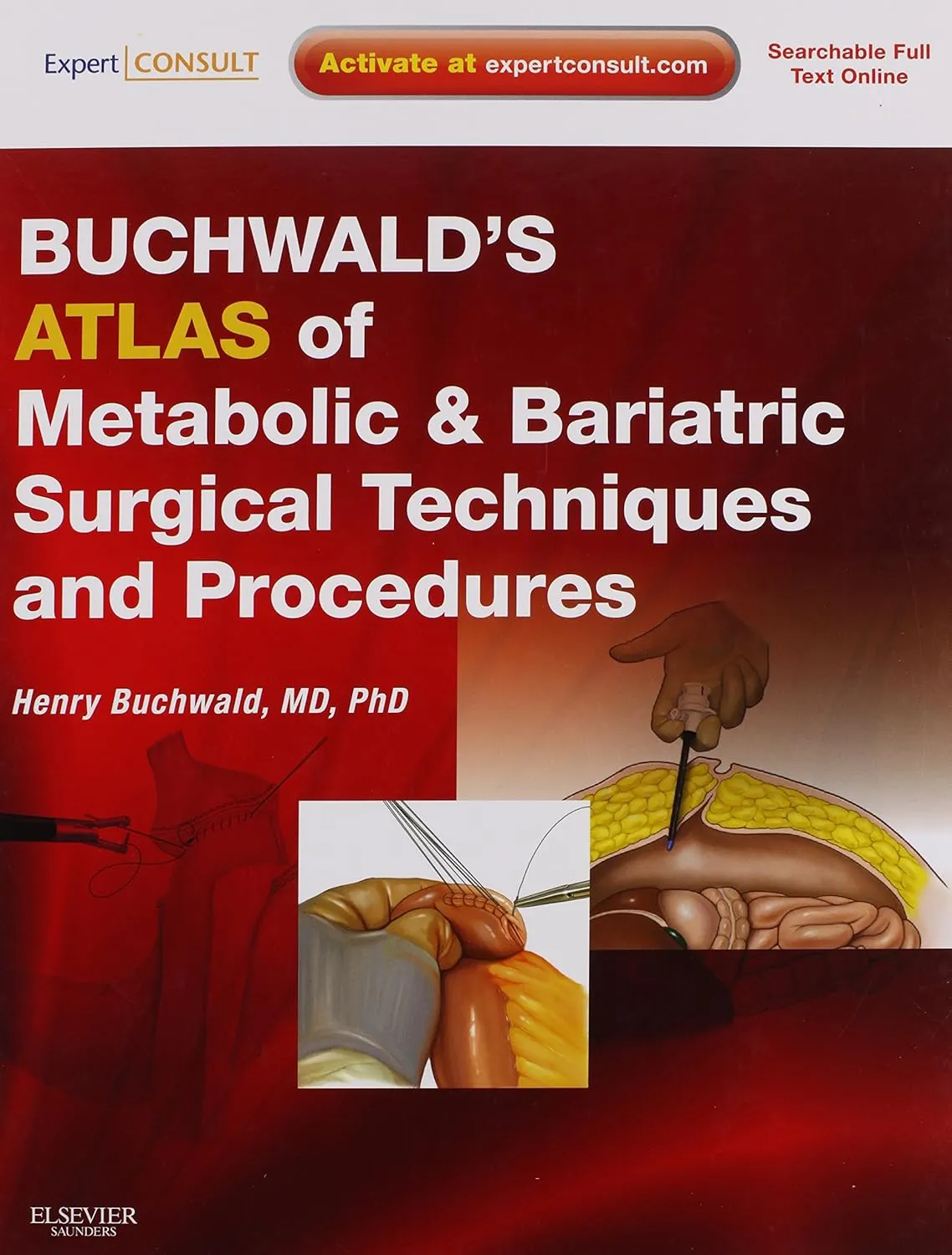 Buchwald's Atlas of Metabolic and Bariatric Surgical Techniques and Procedures | Hardcover