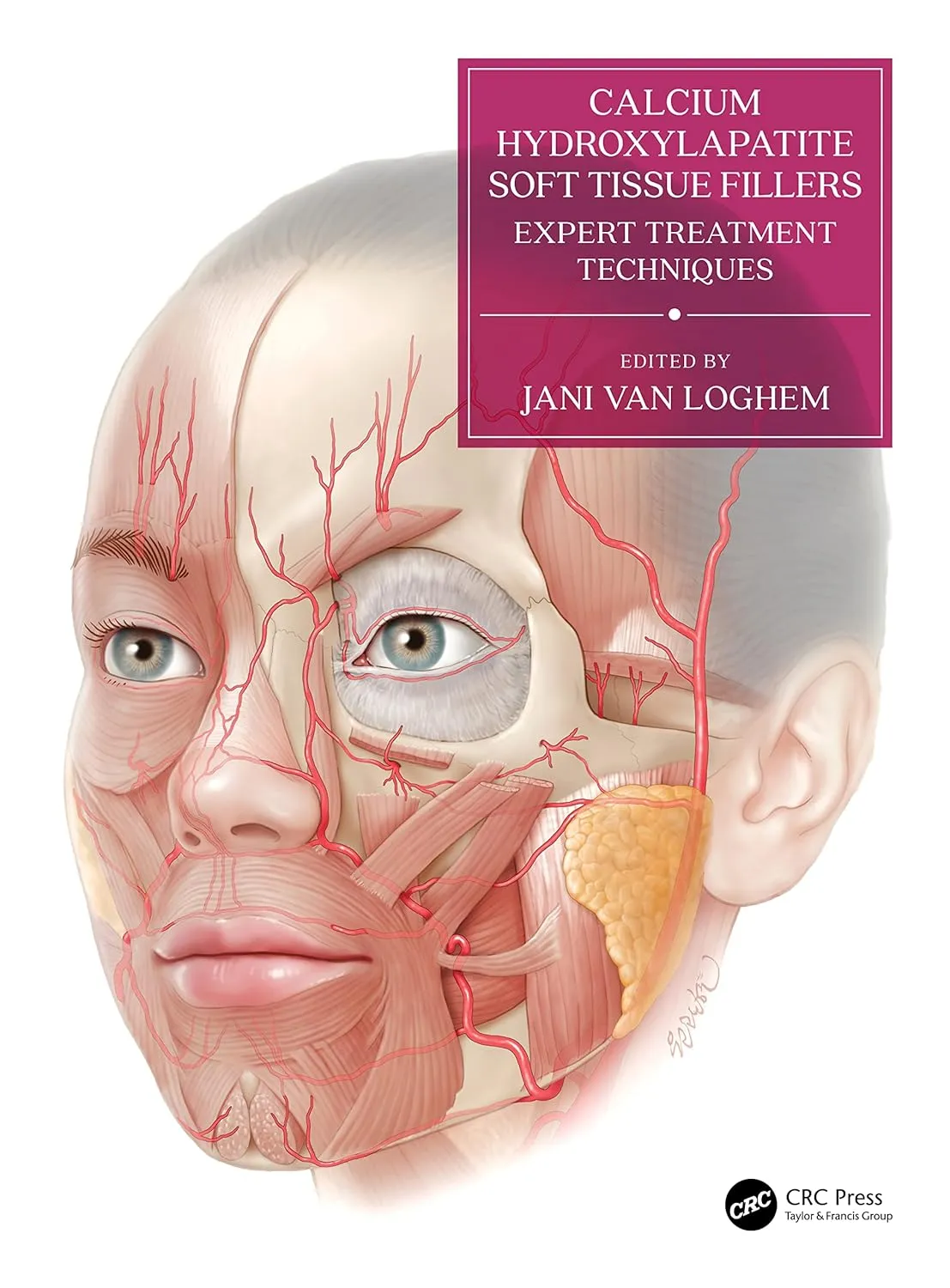Calcium Hydroxylapatite Soft Tissue Fillers Expert Treatment Techniques With Access Code | Hardcover