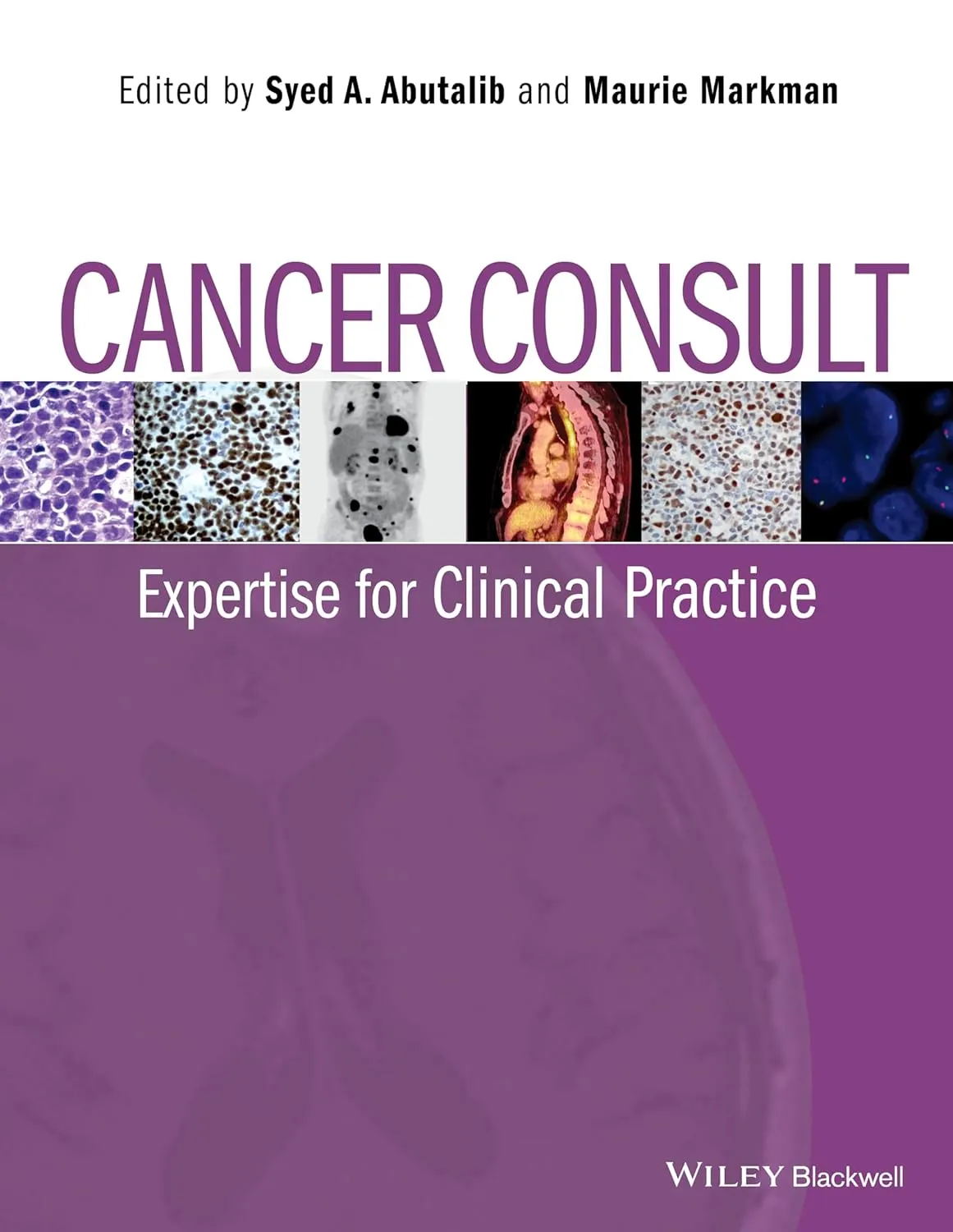 Cancer Consult Expertise for Clinical Practice | Paperback