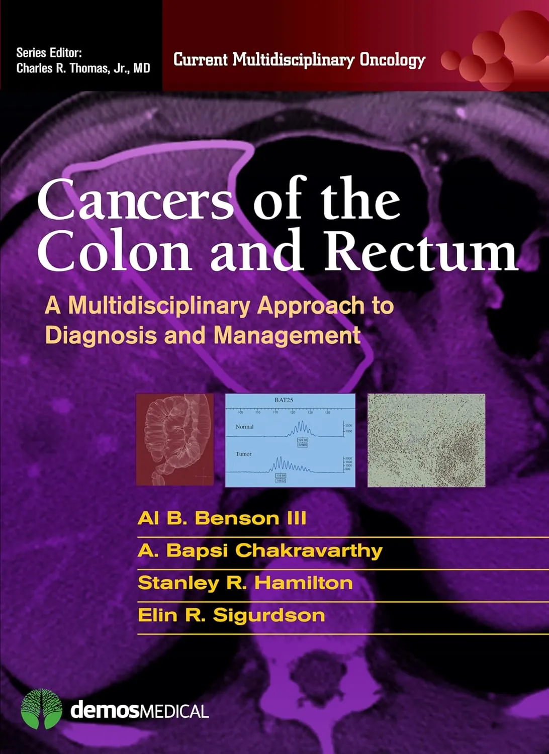 Cancers of the Colon and Rectum | Hardcover