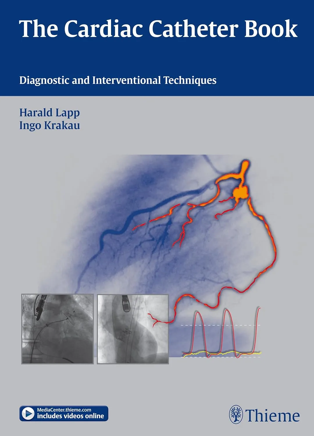 The Cardiac Catheter Book Diagnostic and Interventional Techniques | Hardcover