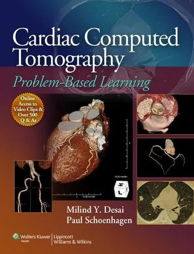 Cardiac Computed Tomography Problem-Based Learning | Paperback