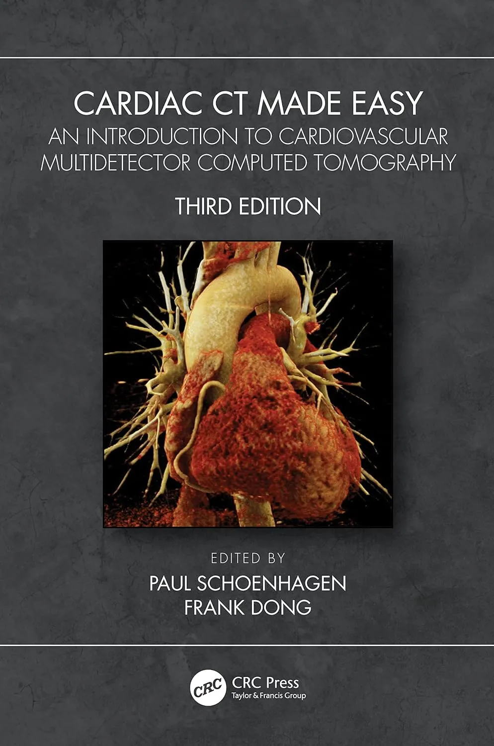 Cardiac Ct Made Easy An Introduction To Cardiovascular Multidetector Computed Tomography Third Edition | Paperback