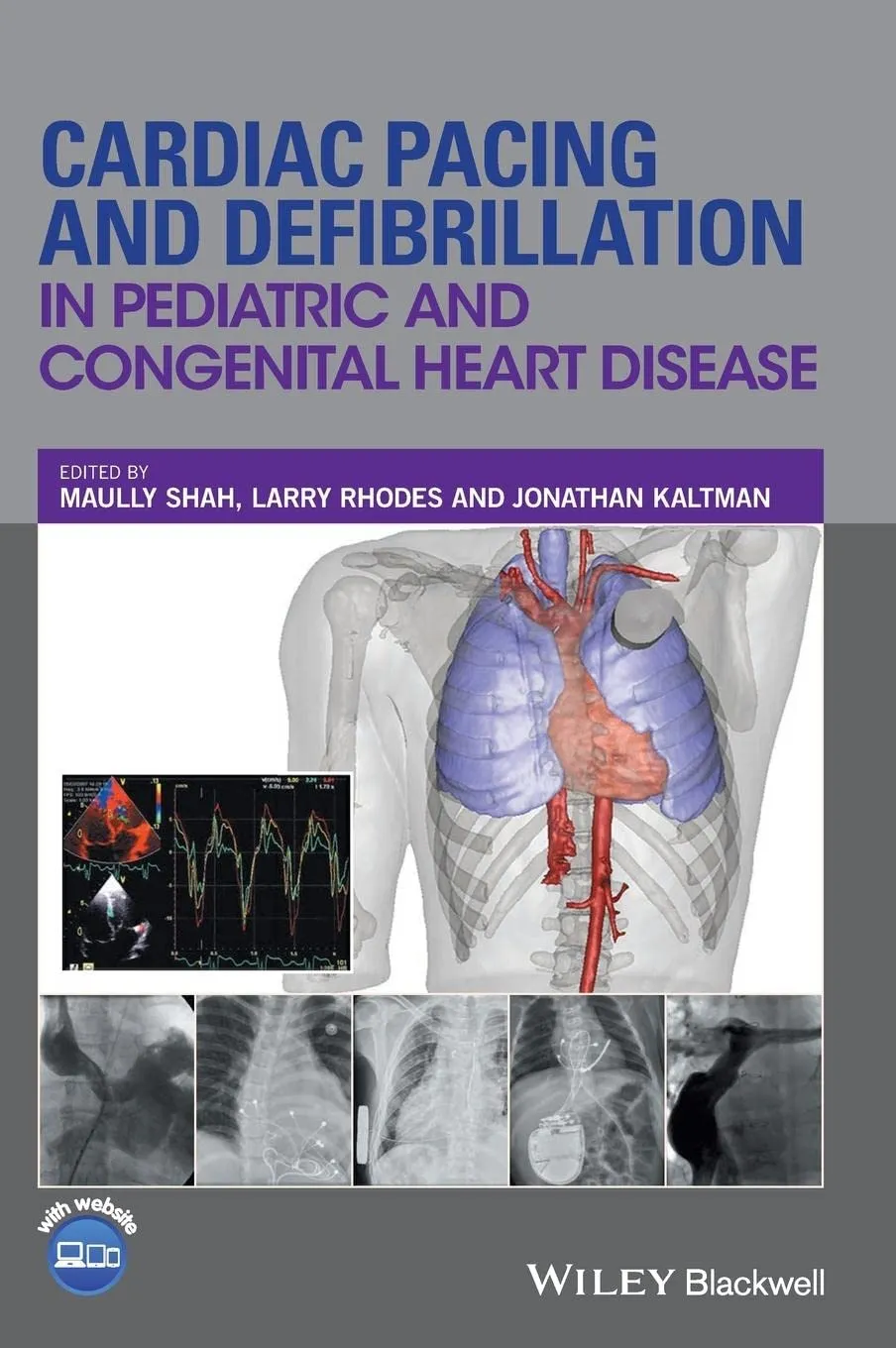 Cardiac Pacing and Defibrillation in Pediatric and Congenital Hearth Disease | Hardcover