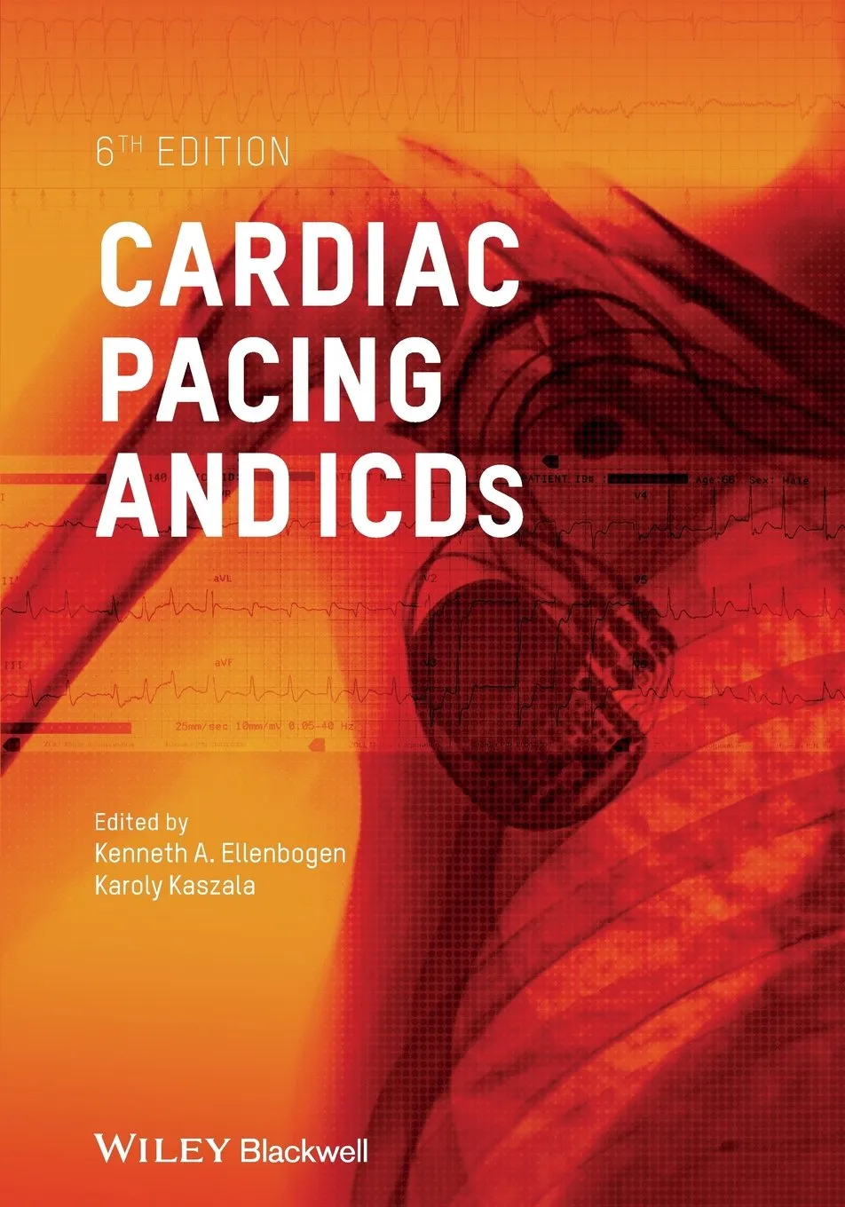 Cardiac Pacing and ICDs | 6th Edition | Paperback
