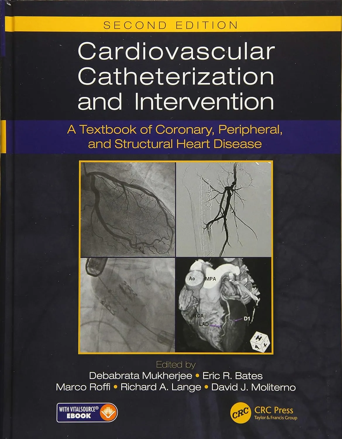 Cardiovascular Catheterization and Intervention | 2nd Edition | Hardcover