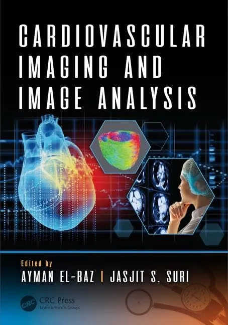 Cardiovascular Imaging and Image Analysis | Hardcover