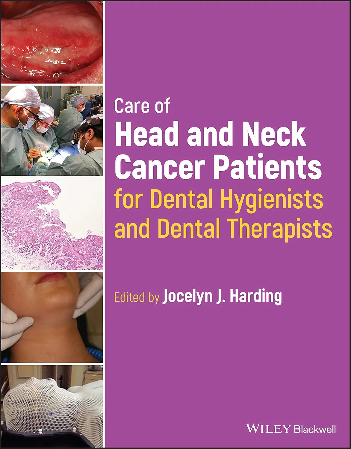 Care Of Head And Neck Cancer Patients For Dental Hygienists And Dental Therapists | Paperback