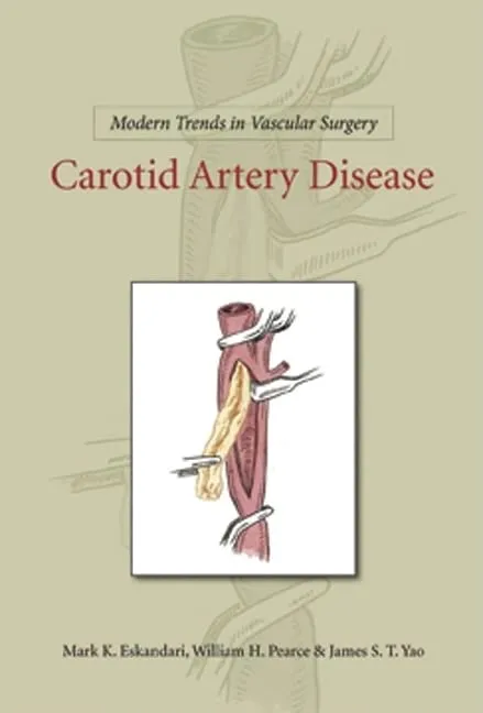Carotid Artery DiseaseModern Trends in Vascular Surgery | Hardcover