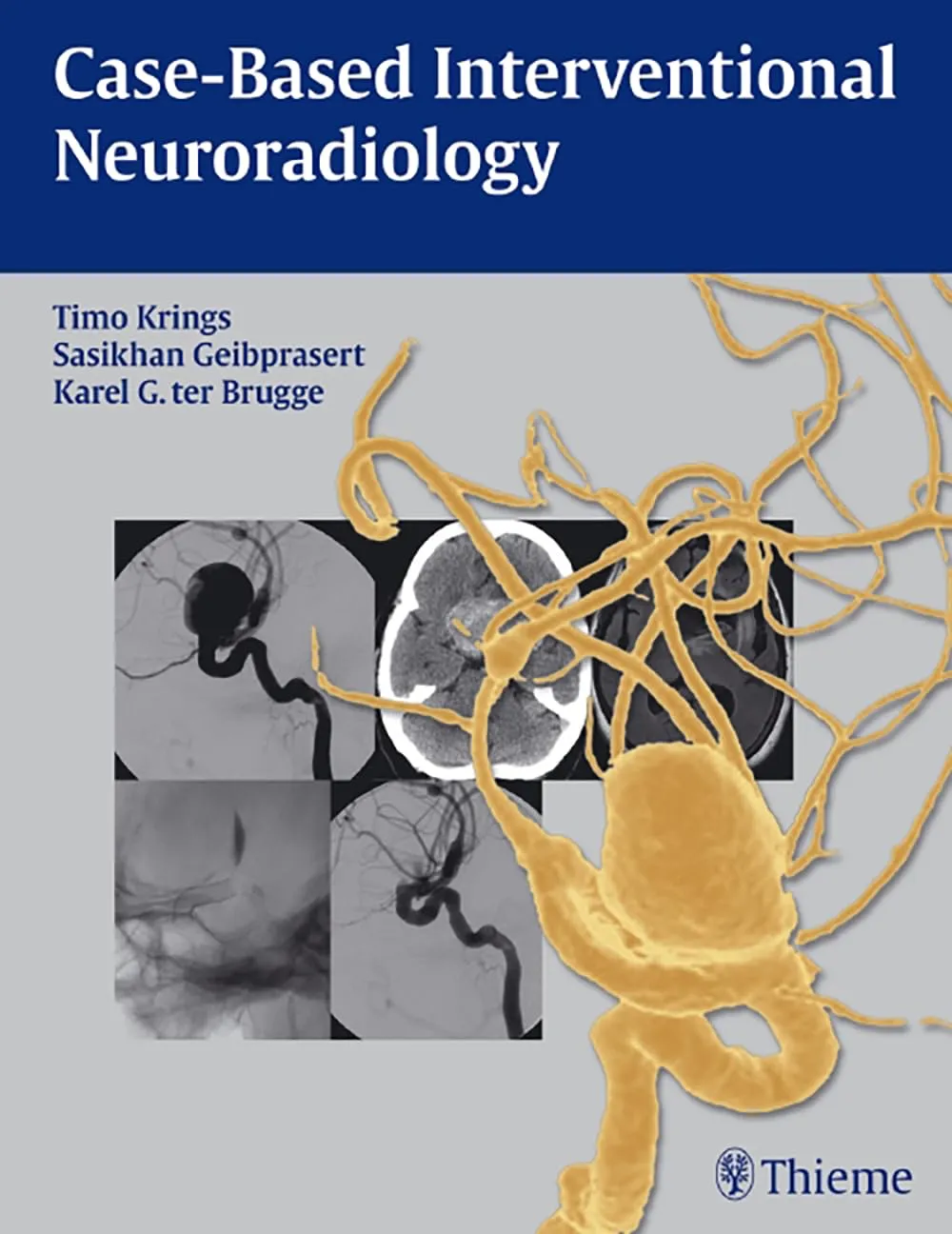 Case-Based Interventional Neuroradiology | Paperback