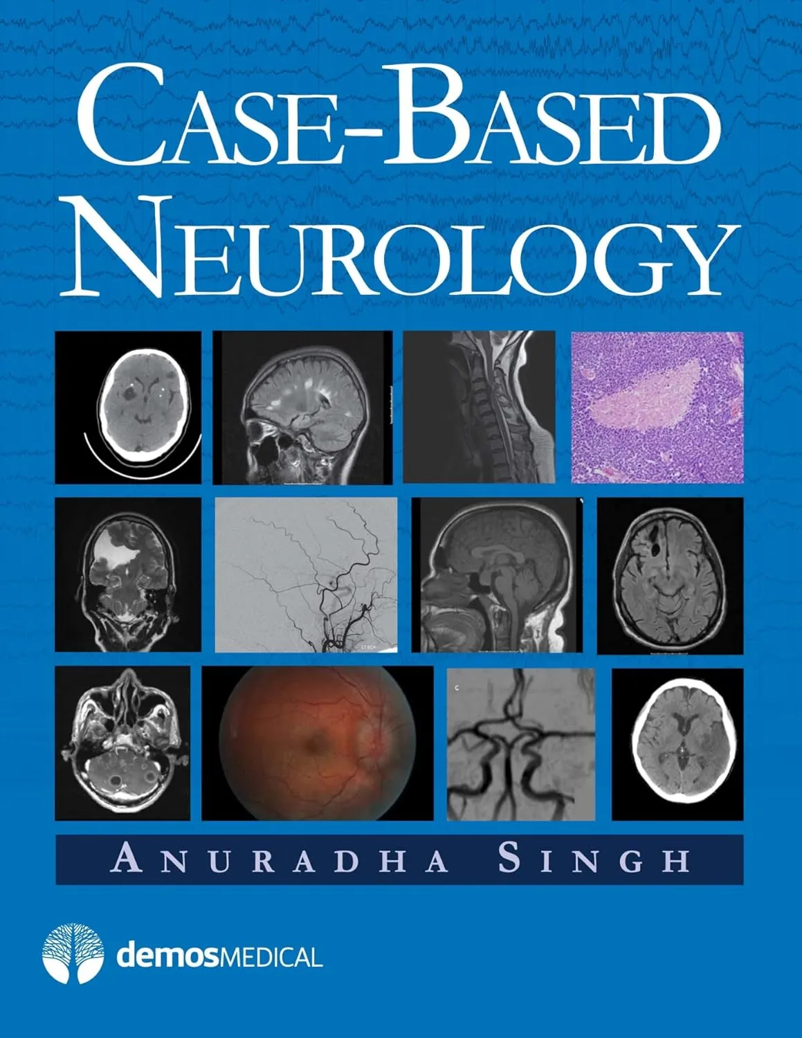 Case-Based Neurology | Hardcover