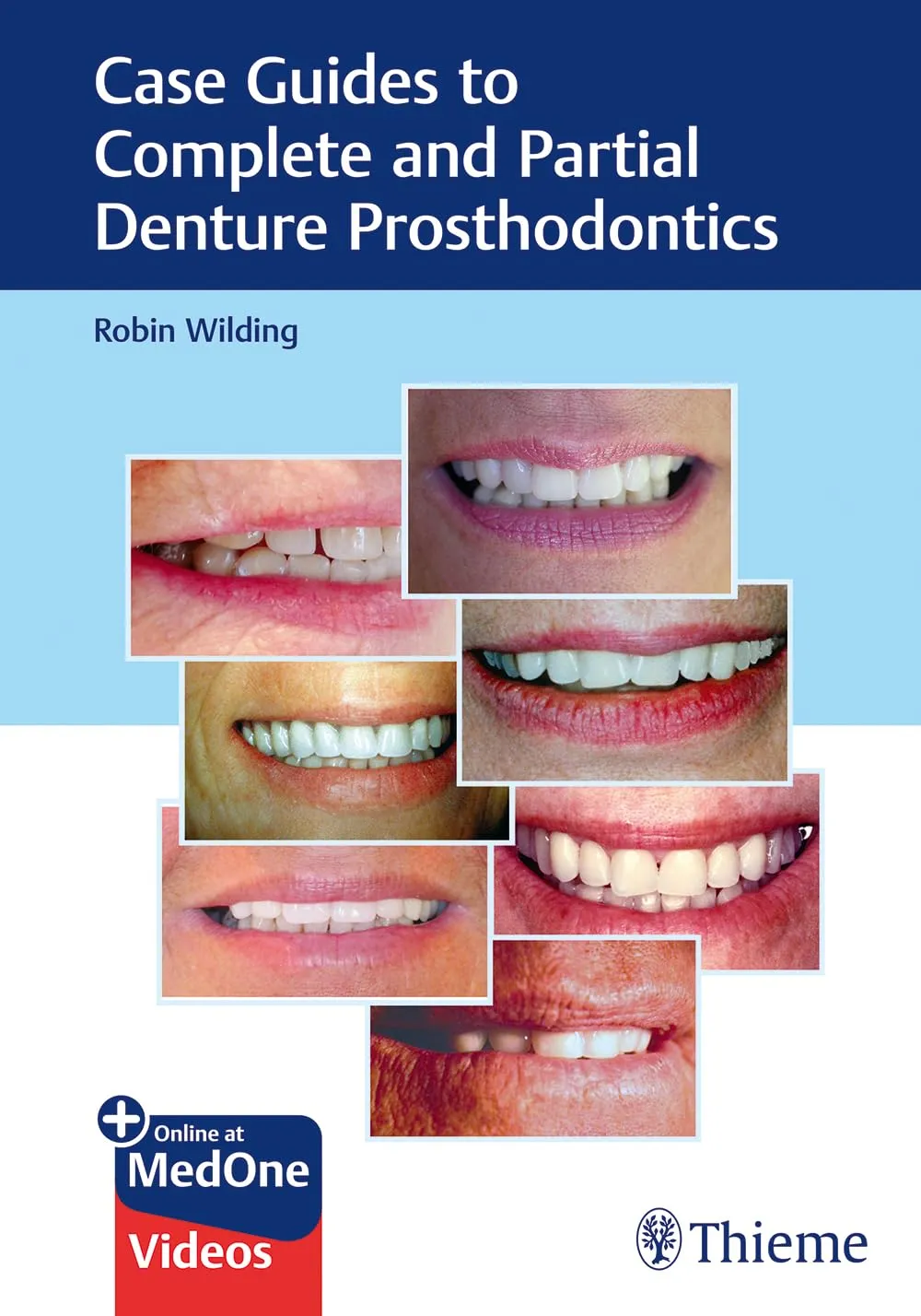 Case Guides to Complete and Partial Denture Prosthodontics | Paperback