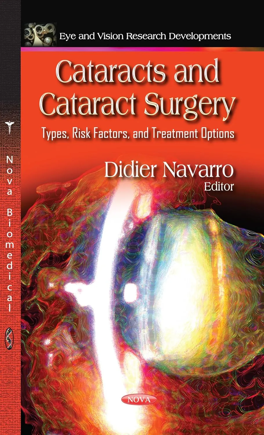 Cataracts and Cataract Surgery | Hardcover