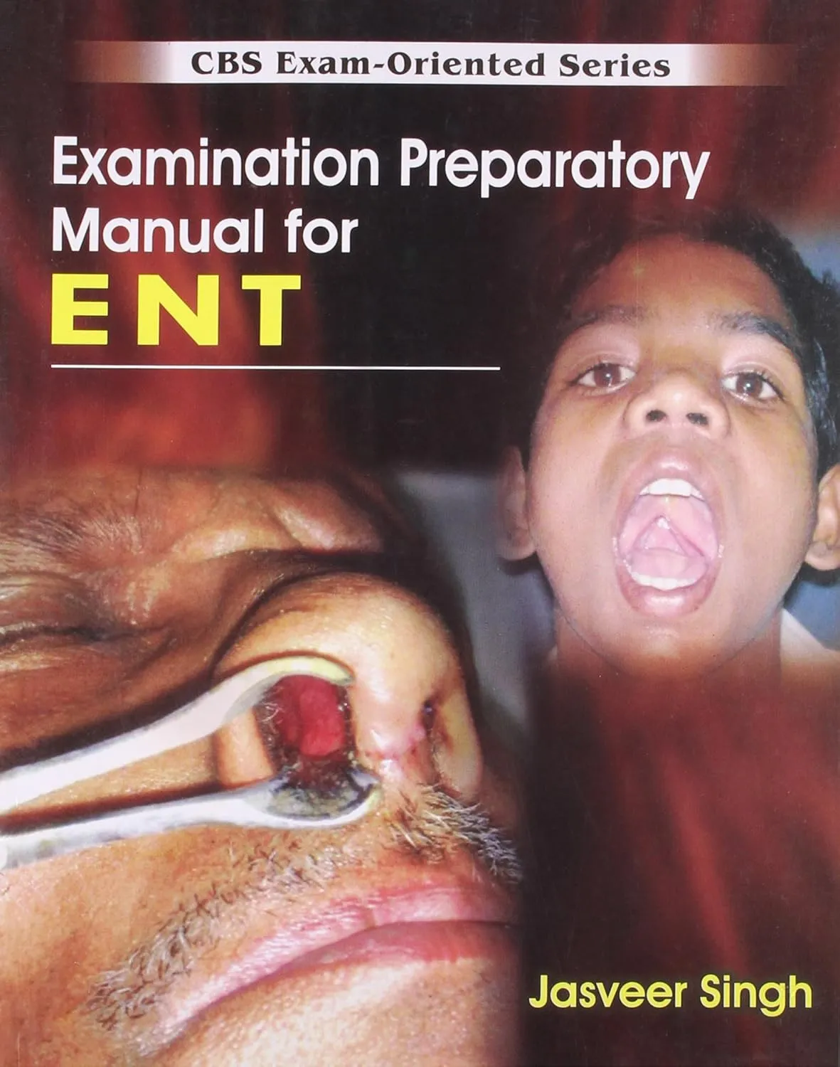 CBS Exam-Oriented Series Examination Preparatory Manual for ENT | Paperback
