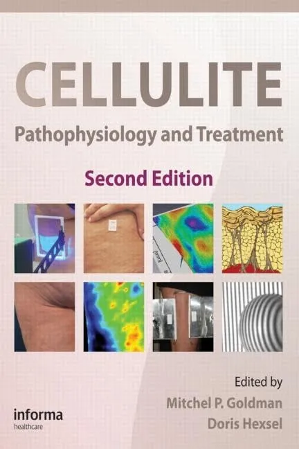 Cellulite Pathophysiology and Treatment | 2nd Edition | Hardcover
