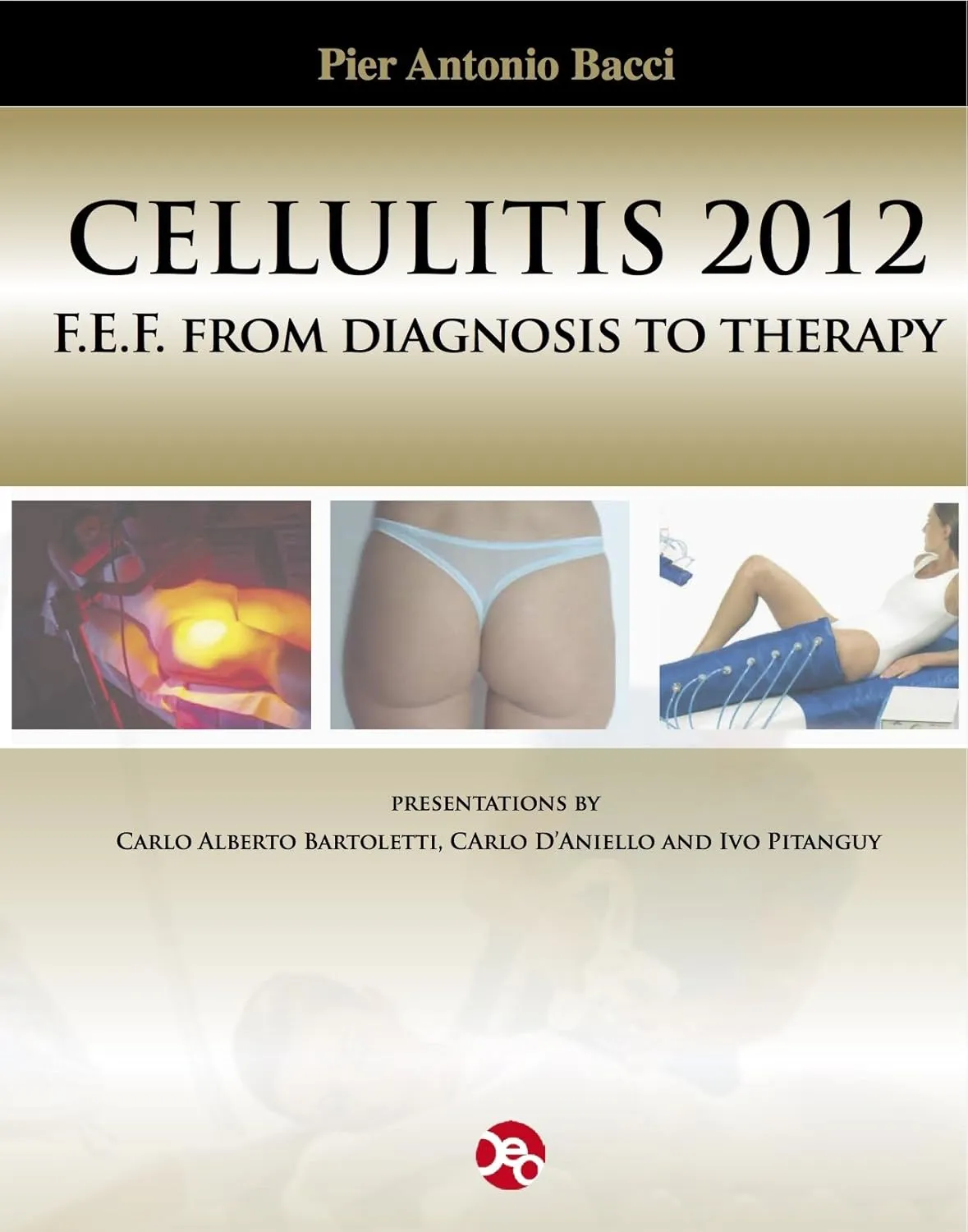 Cellulitis 2012 F.E.F. From Diagnosis to Therapy - Female Evolutive Fibroedema | Hardcover