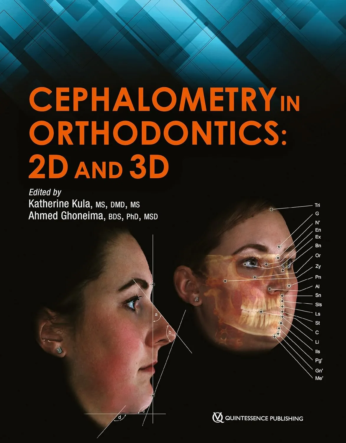 Cephalometry in Orthodontics 2D and 3D | Hardcover