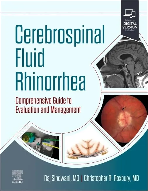 Cerebrospinal Fluid Rhinorrhea Comprehensive Guide To Evaluation And Management With Access Code | Hardcover