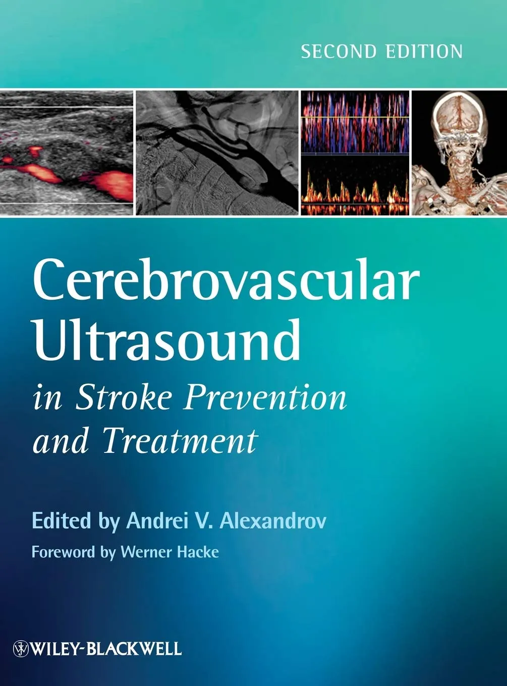 Cerebrovascular Ultrasound in Stroke Prevention and Treatment | 2nd Edition | Hardcover