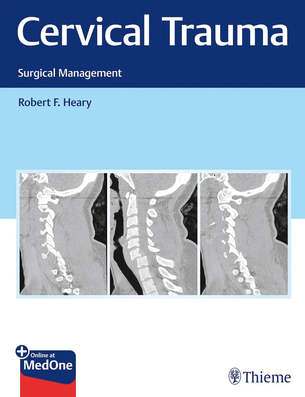 Cervical Trauma Surgical Management | Hardcover