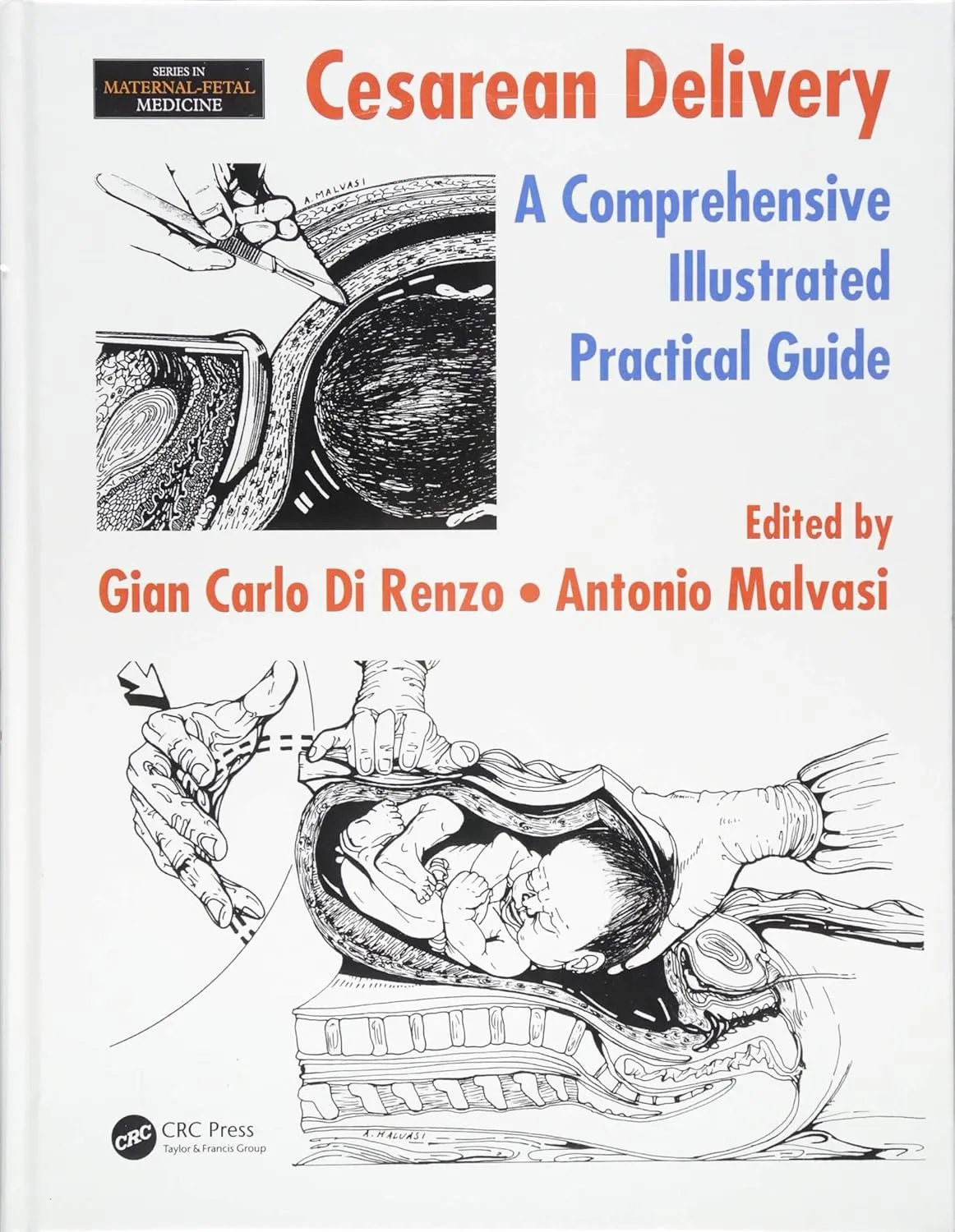 Cesarean Delivery A Comprehensive Illustrated Practical Guide | Hardcover