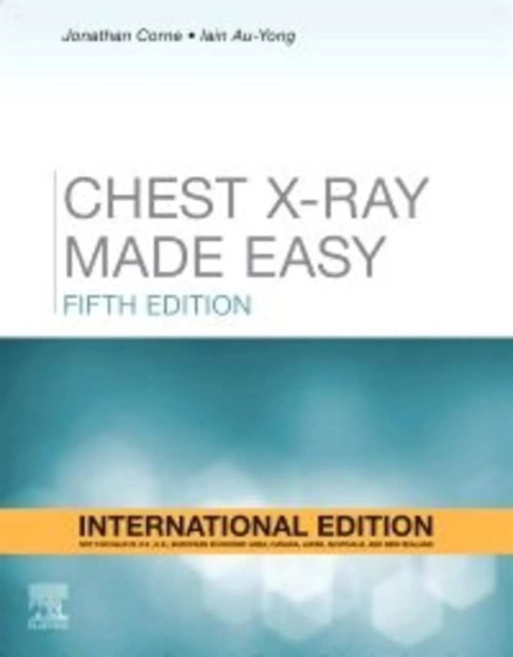 Chest X Ray Made Easy 5th Edition (Ie) | Paperback