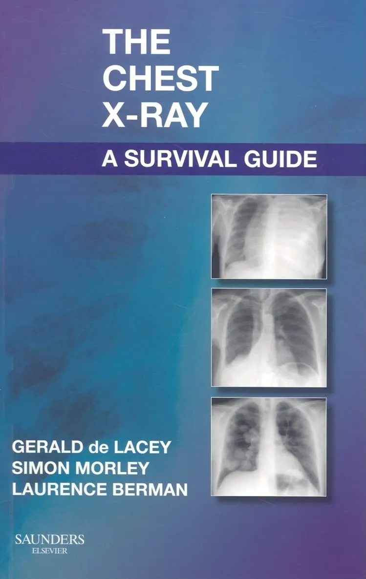 The Chest X-Ray A Surgival Guide IE | Paperback