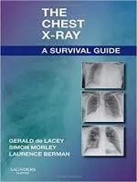 The Chest X-Ray A Survival Guide | Paperback