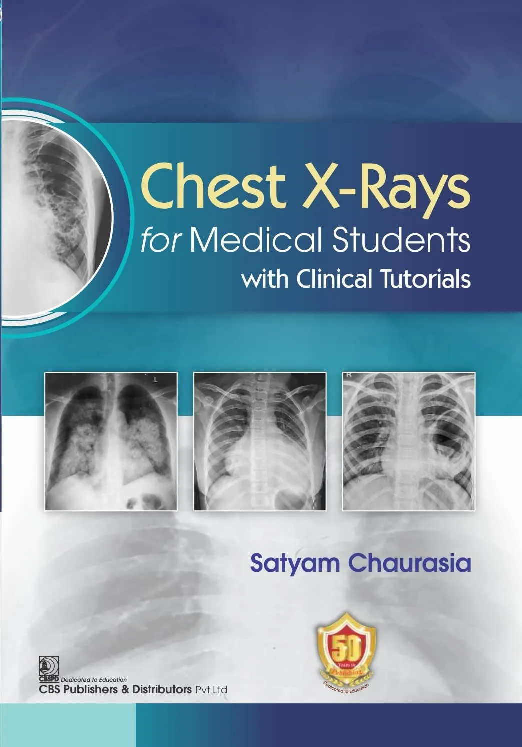 Chest X Rays For Medical Students With Clinical Tutorials | Paperback