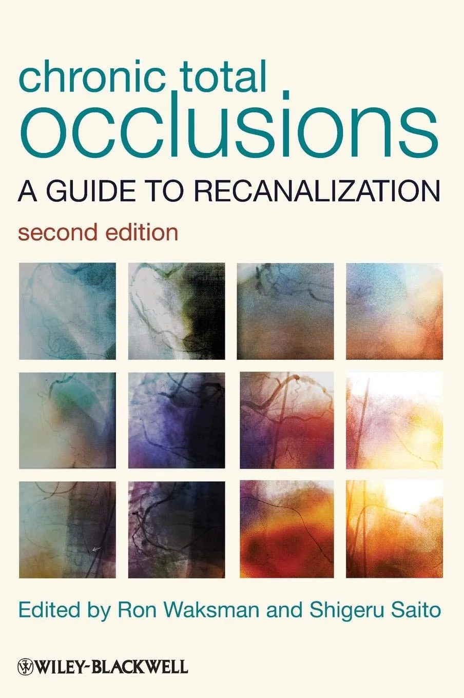 Chronic Total Occlusions A Guide to Recanalization | 2nd Edition | Hardcover
