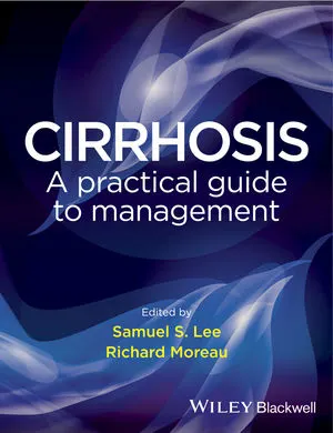 Cirrhosis A Practical Guide to Management | 1st Edition | Hardcover