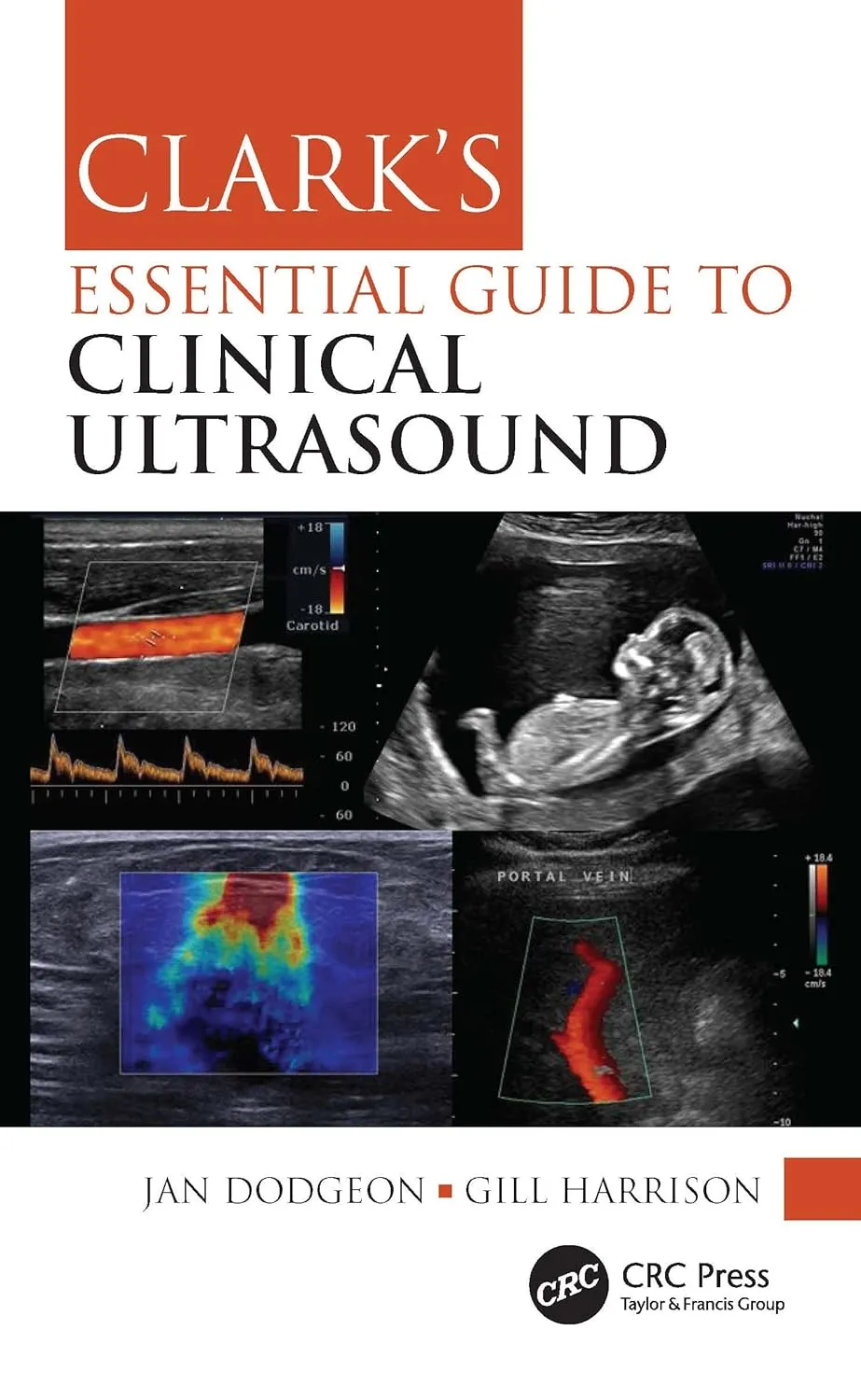 Clarks Essential Guide To Clinical Ultrasound | Paperback