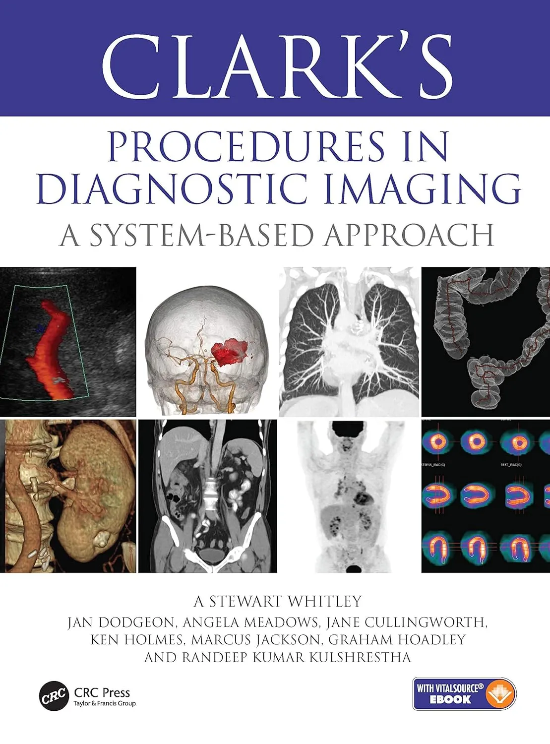 Clarks Procedures In Diagnostic Imaging A System Based Approach With Access Code | Hardcover