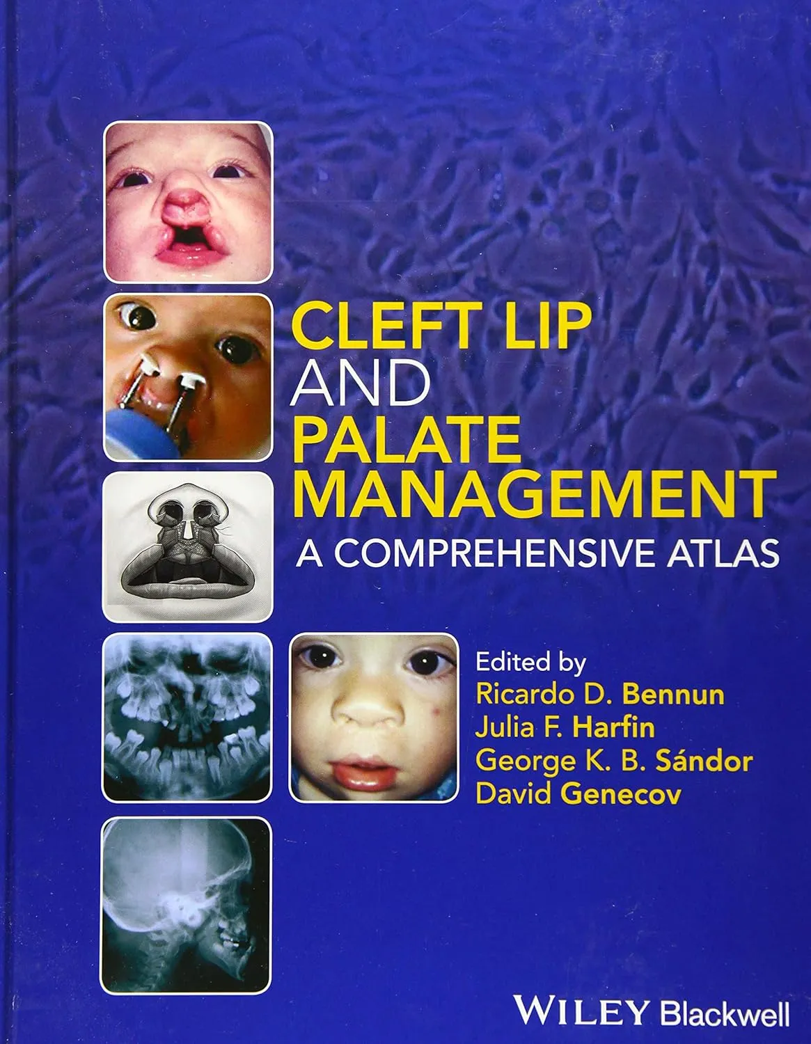 Cleft Lip and Palate Management A Comprehensive Atlas | Hardcover